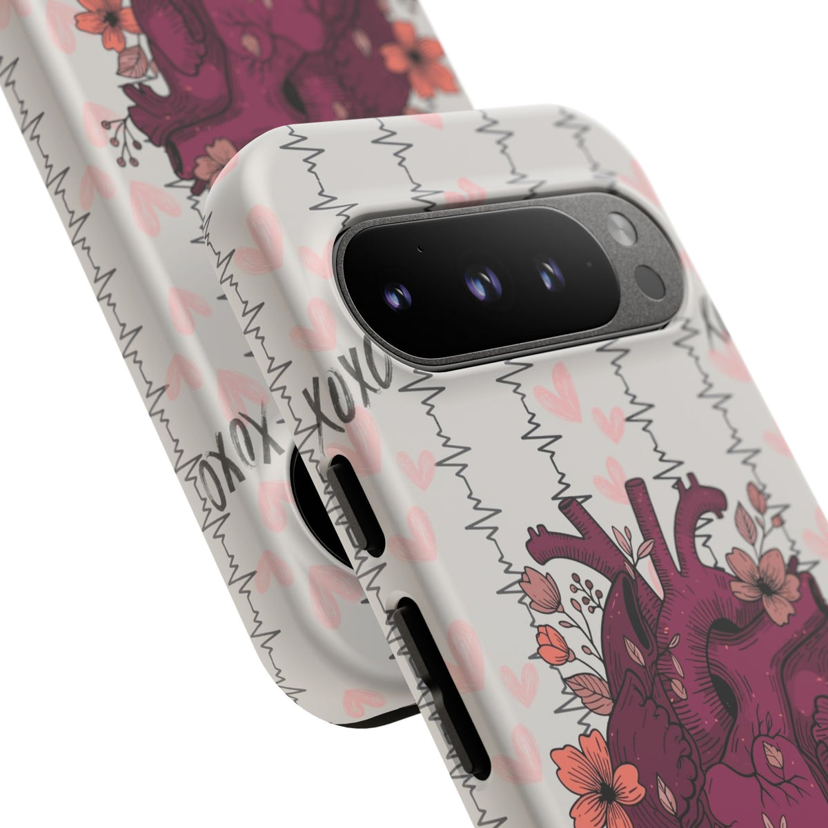 Anatomical Heart Phone Case