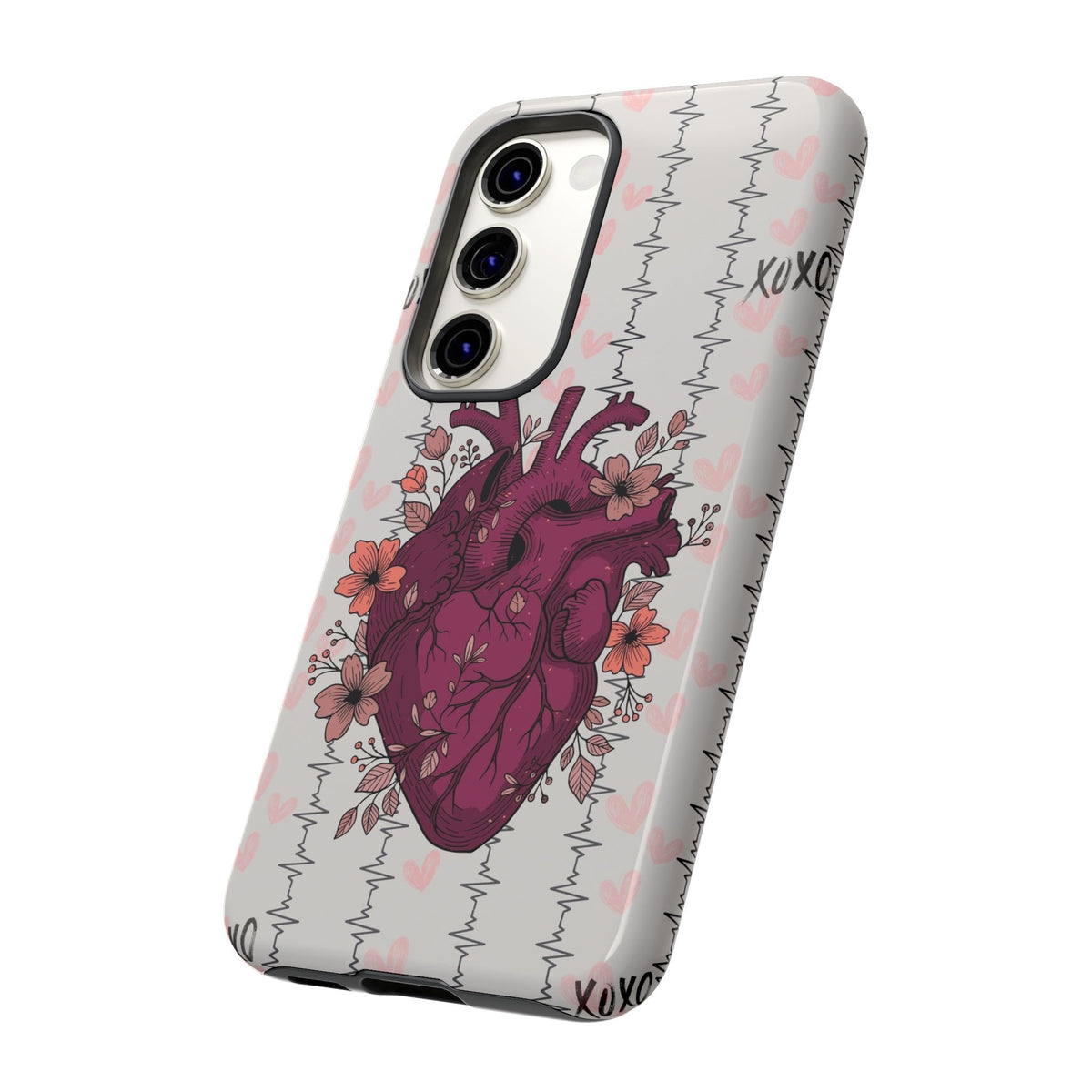 Anatomical Heart Phone Case