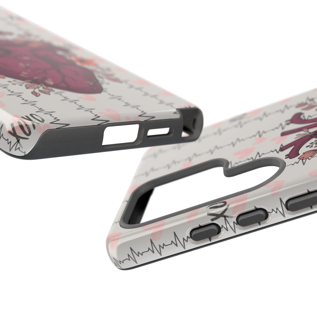 Anatomical Heart Phone Case