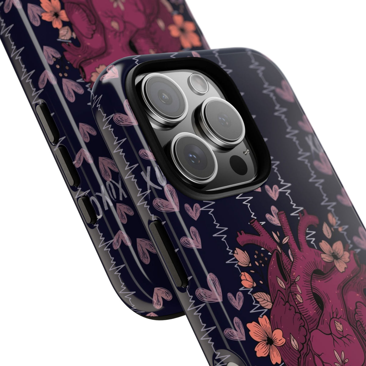Dark Anatomical Heart Phone Case