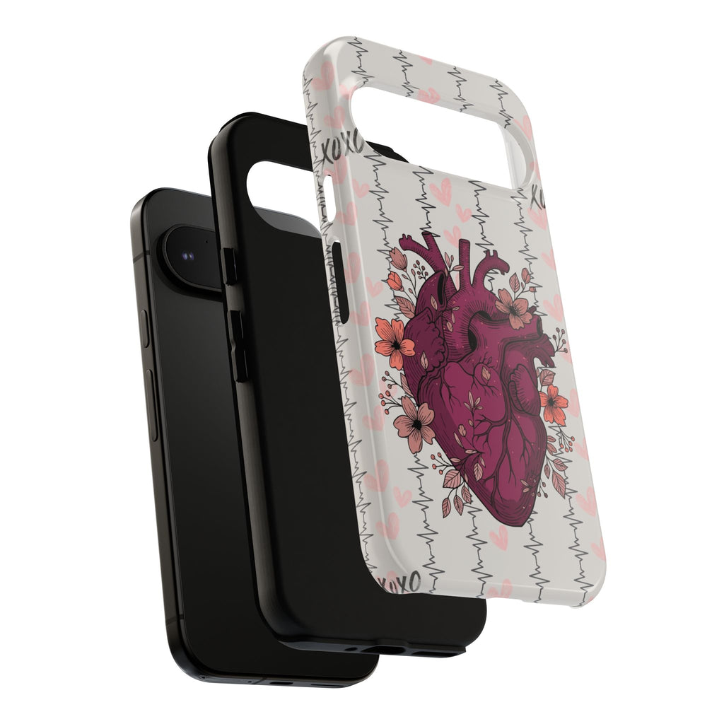 Anatomical Heart Phone Case