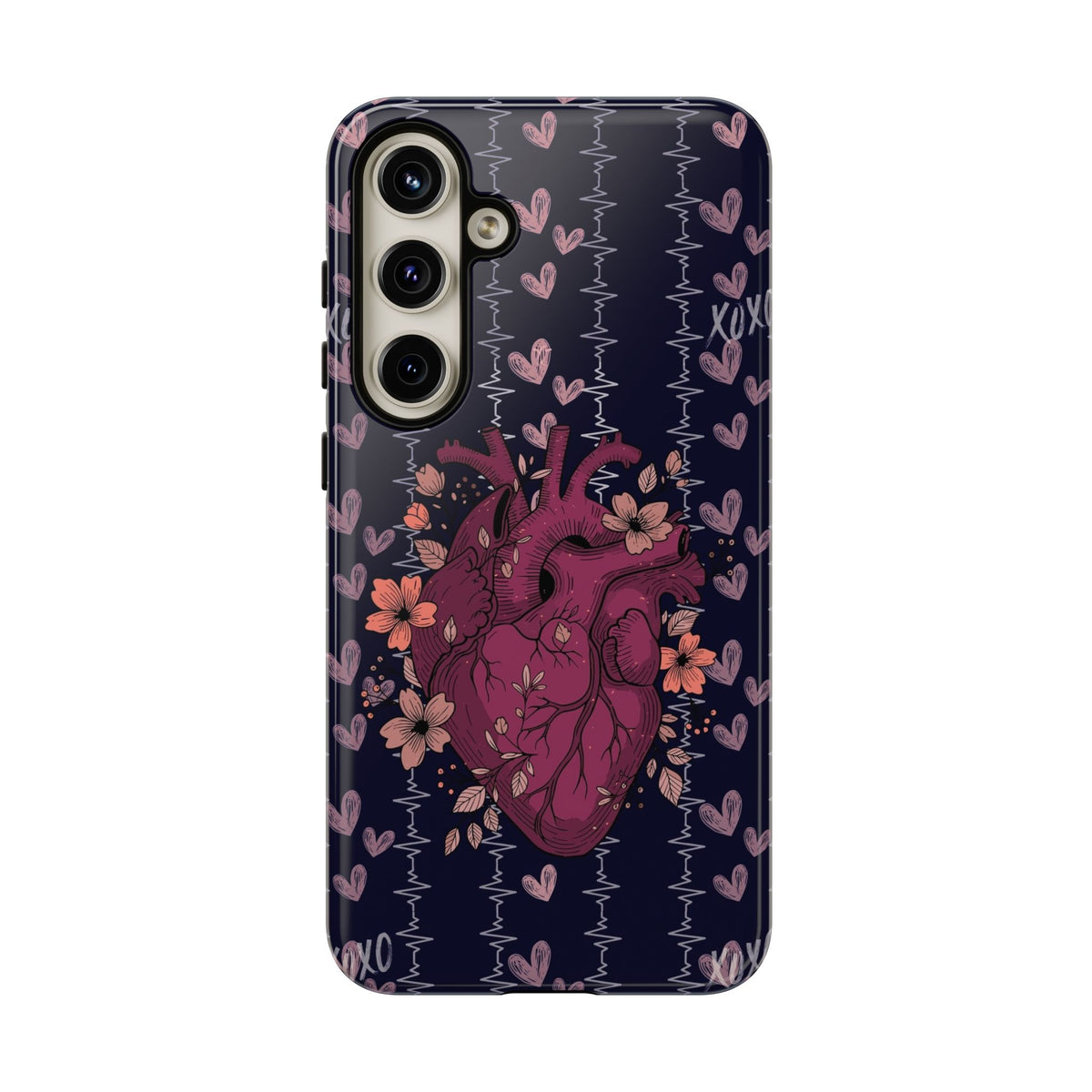 Dark Anatomical Heart Phone Case