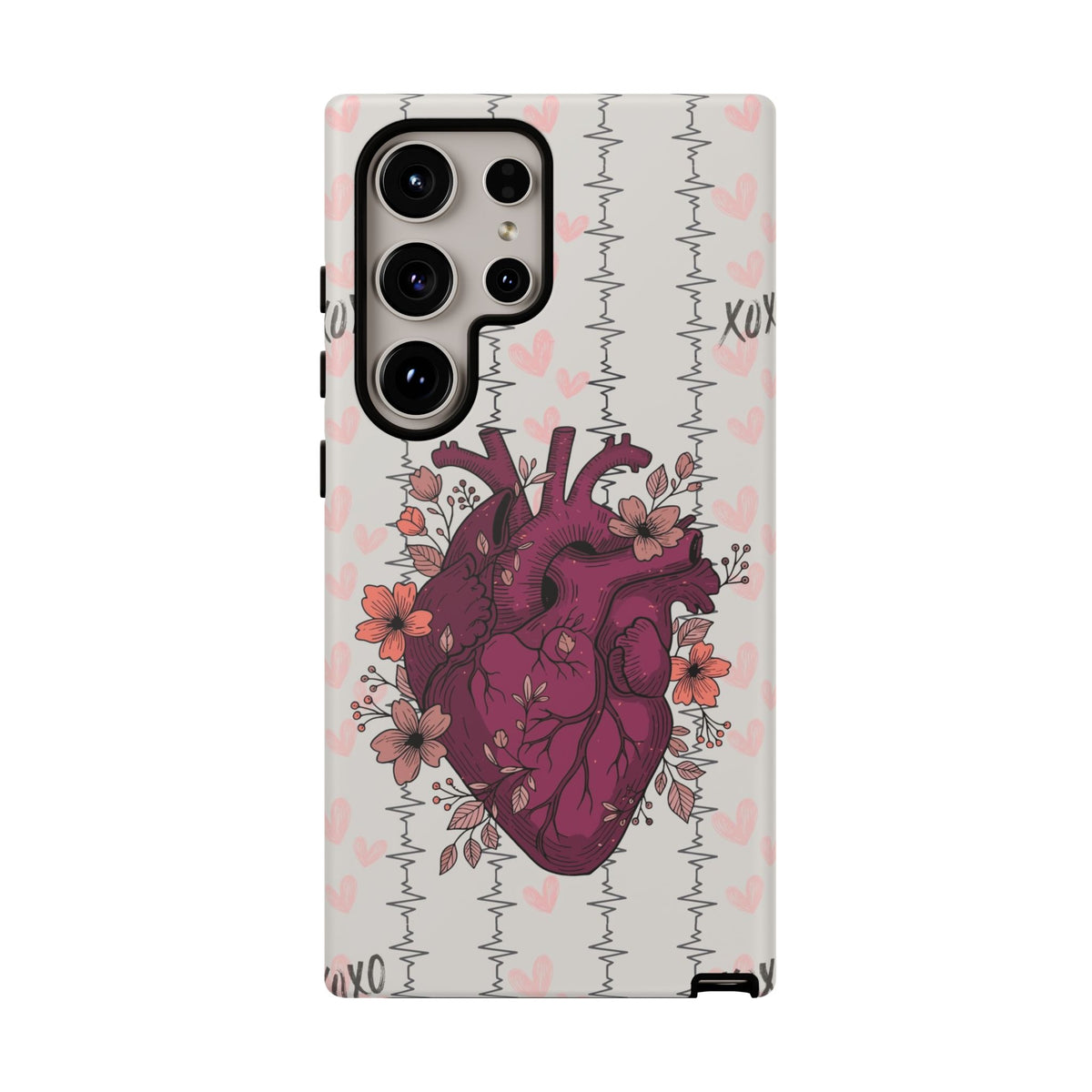 Anatomical Heart Phone Case