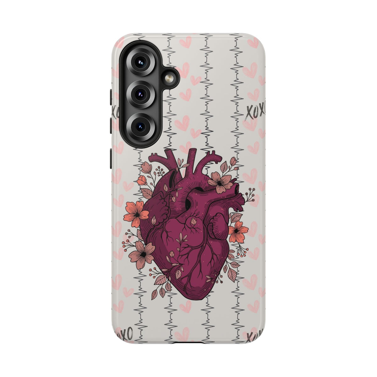 Anatomical Heart Phone Case