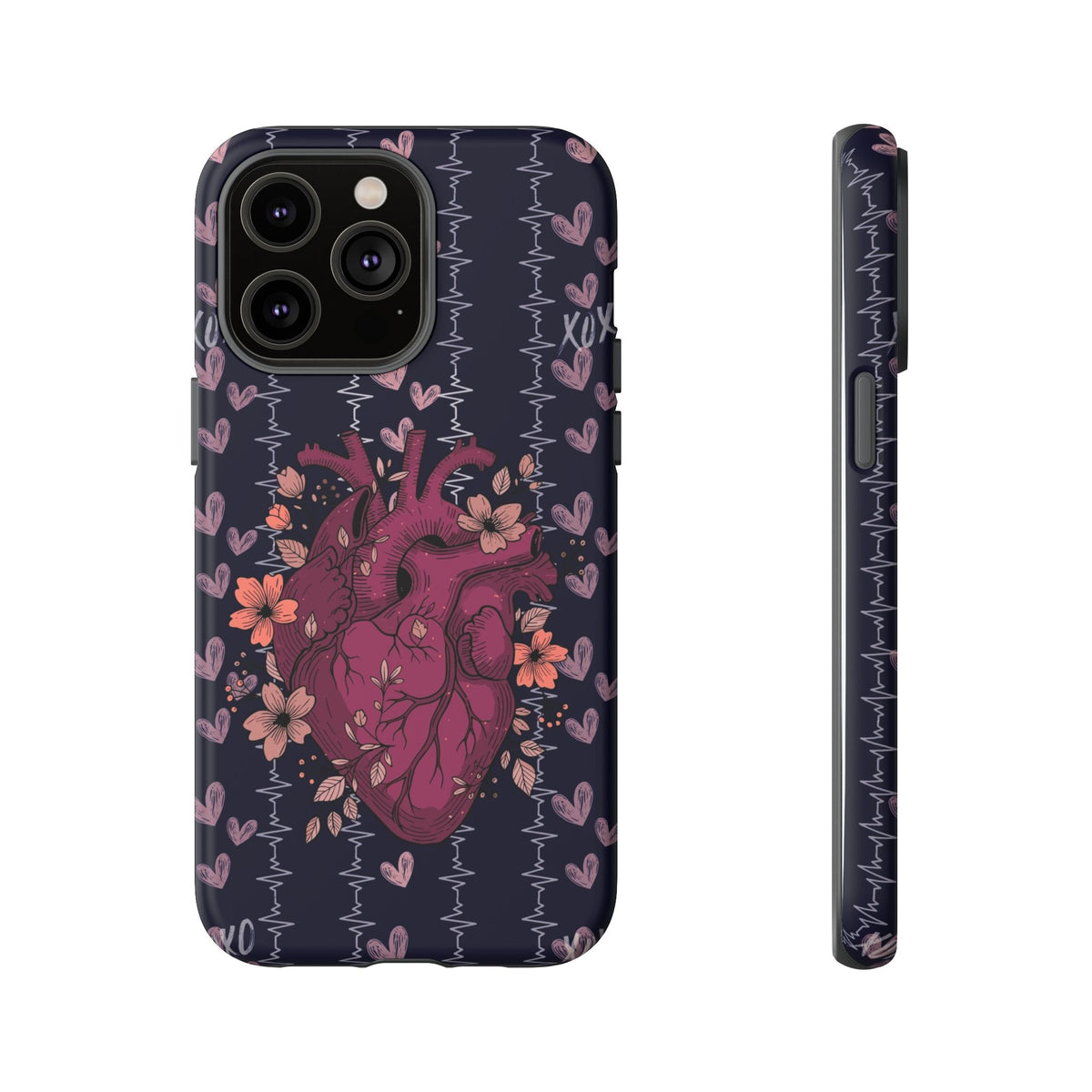Dark Anatomical Heart Phone Case