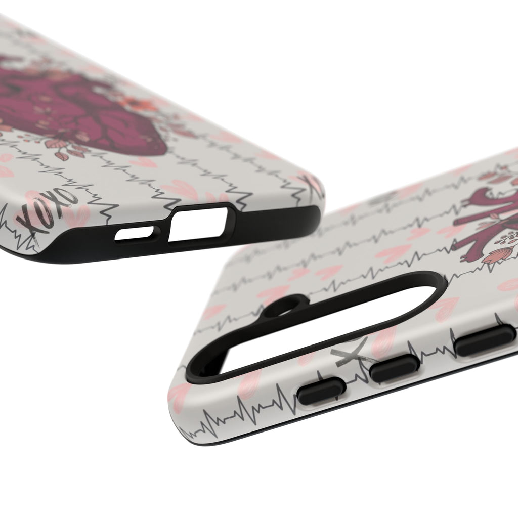 Anatomical Heart Phone Case