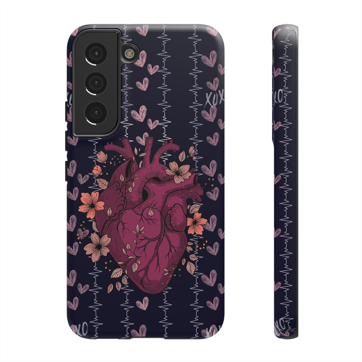 Dark Anatomical Heart Phone Case