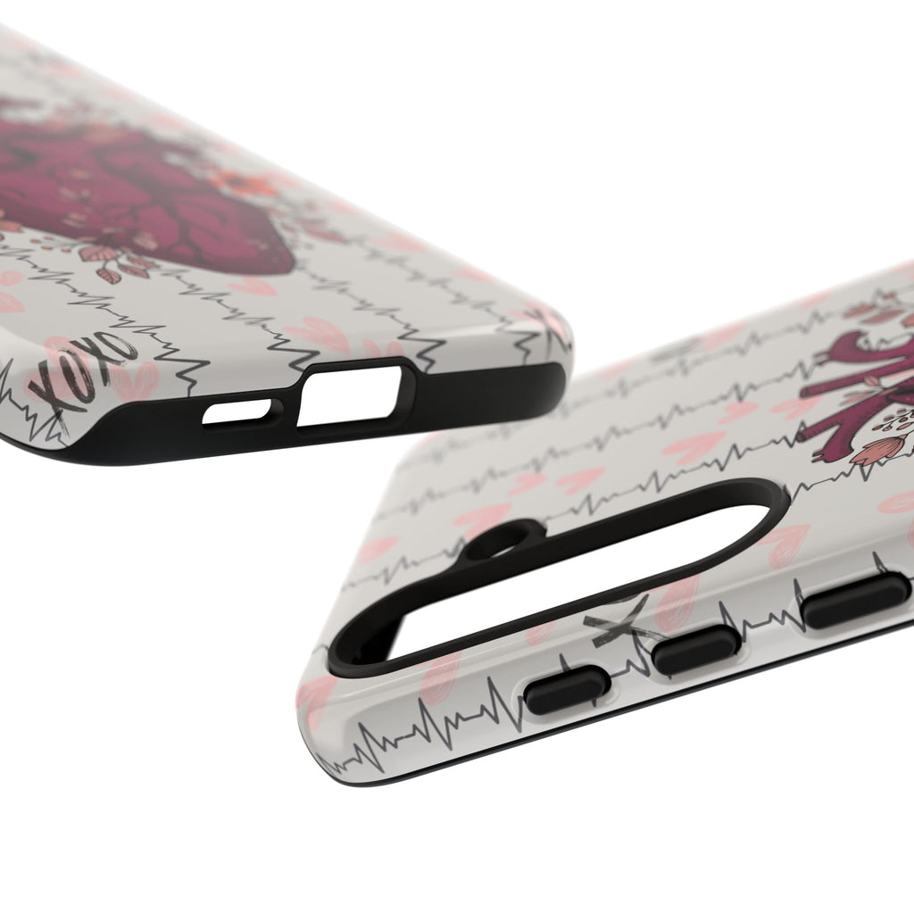 Anatomical Heart Phone Case
