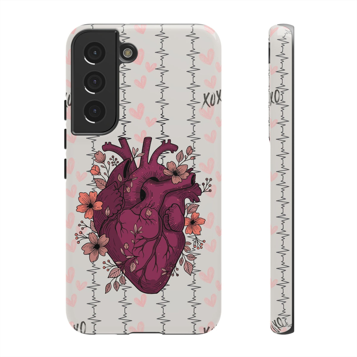 Anatomical Heart Phone Case