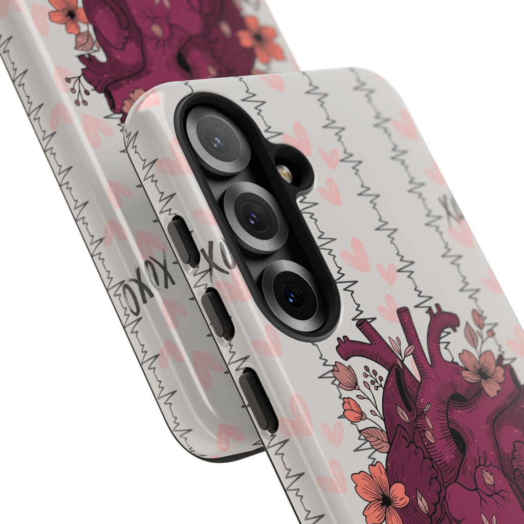 Anatomical Heart Phone Case