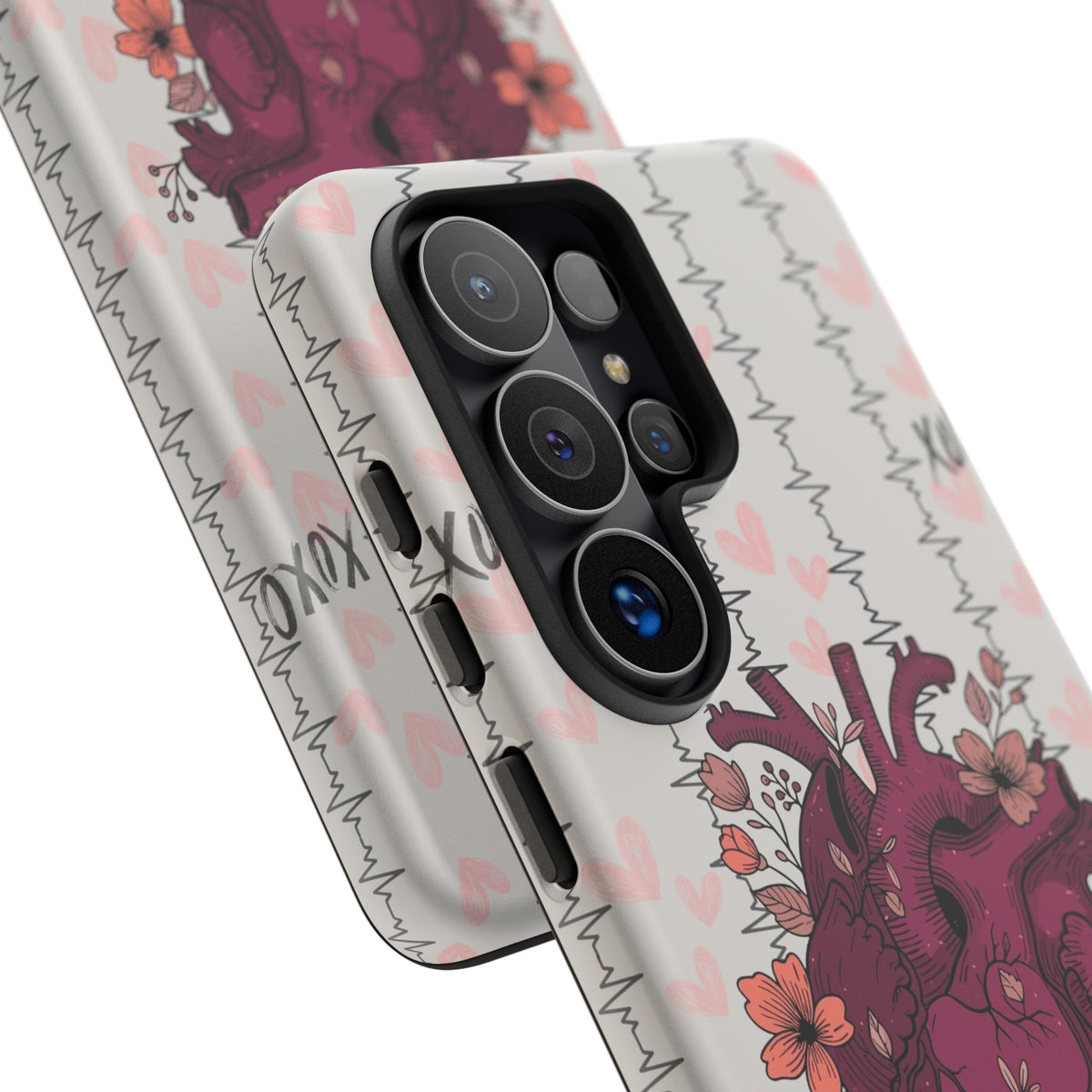 Anatomical Heart Phone Case