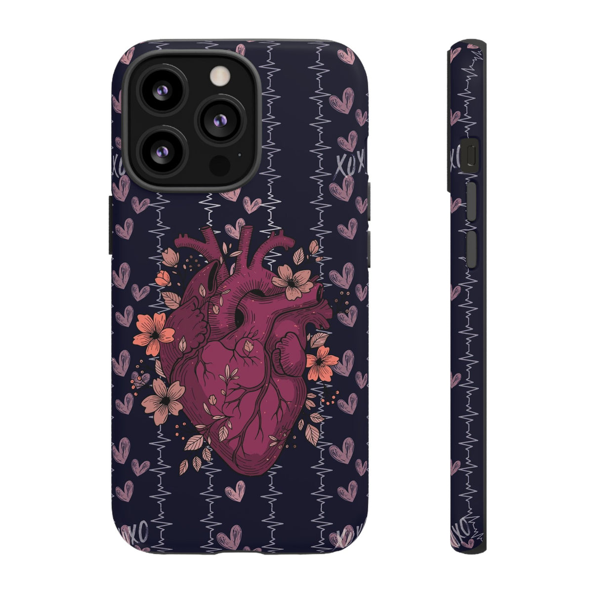 Dark Anatomical Heart Phone Case