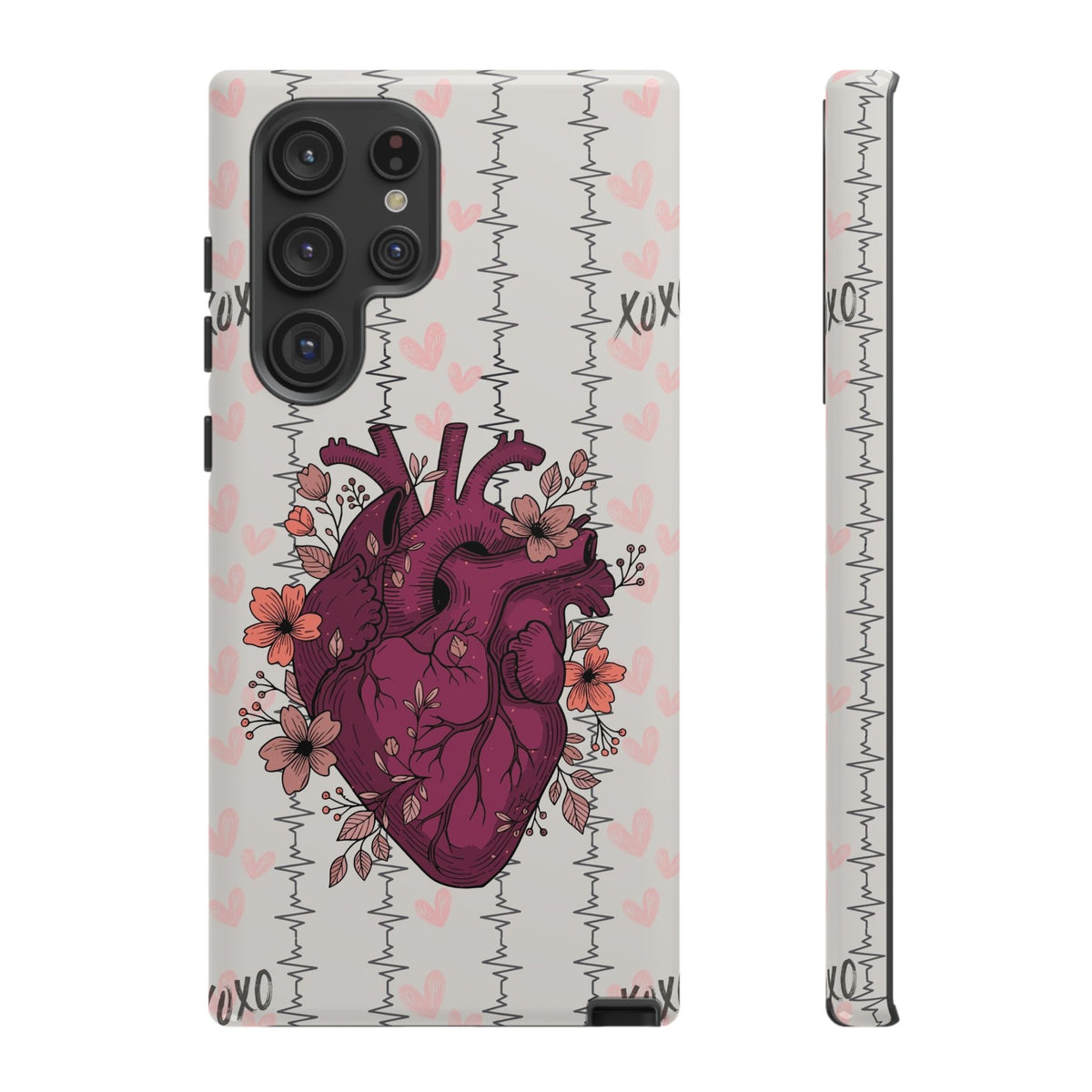 Anatomical Heart Phone Case