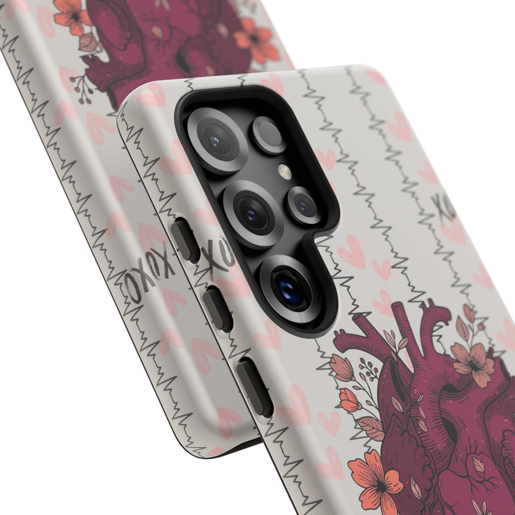 Anatomical Heart Phone Case