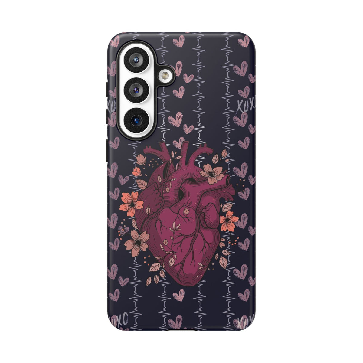 Dark Anatomical Heart Phone Case