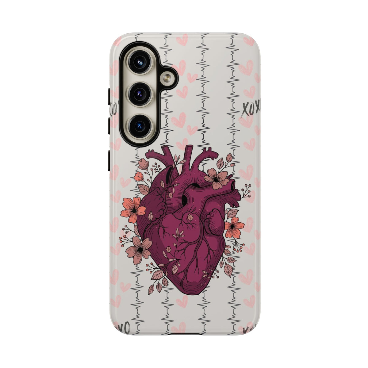 Anatomical Heart Phone Case
