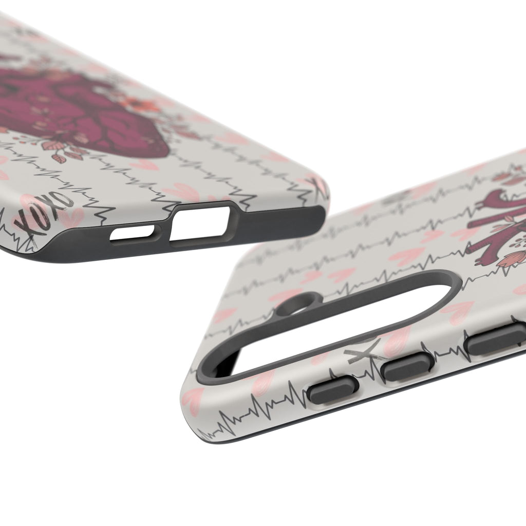 Anatomical Heart Phone Case
