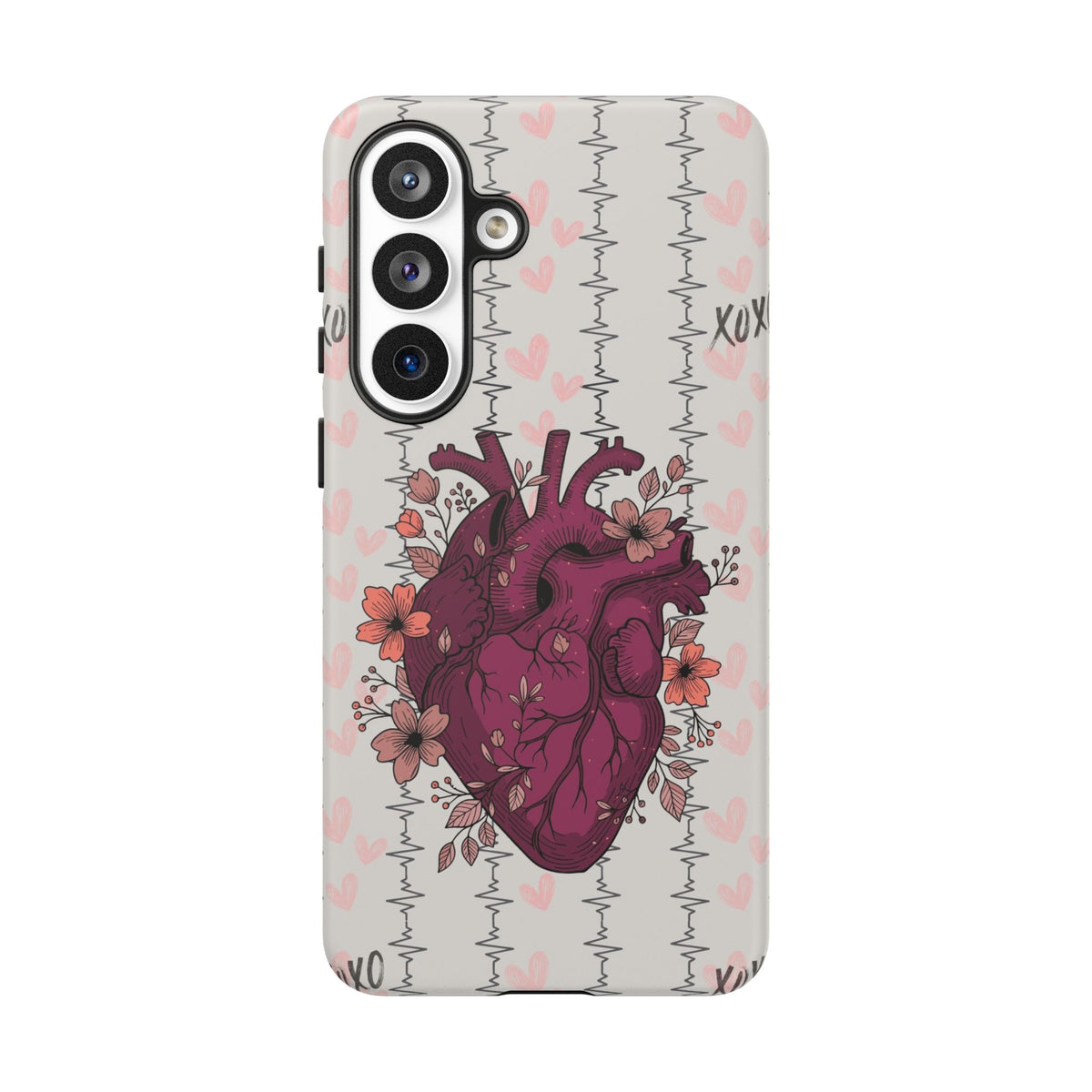Anatomical Heart Phone Case