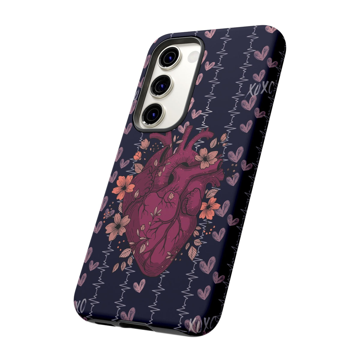 Dark Anatomical Heart Phone Case