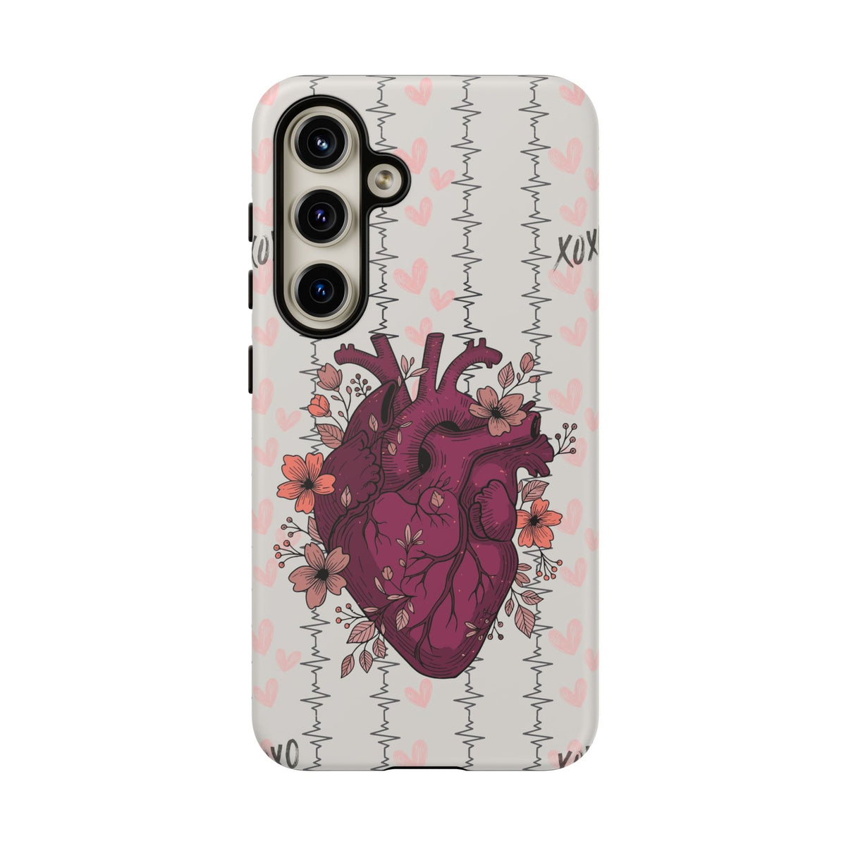 Anatomical Heart Phone Case