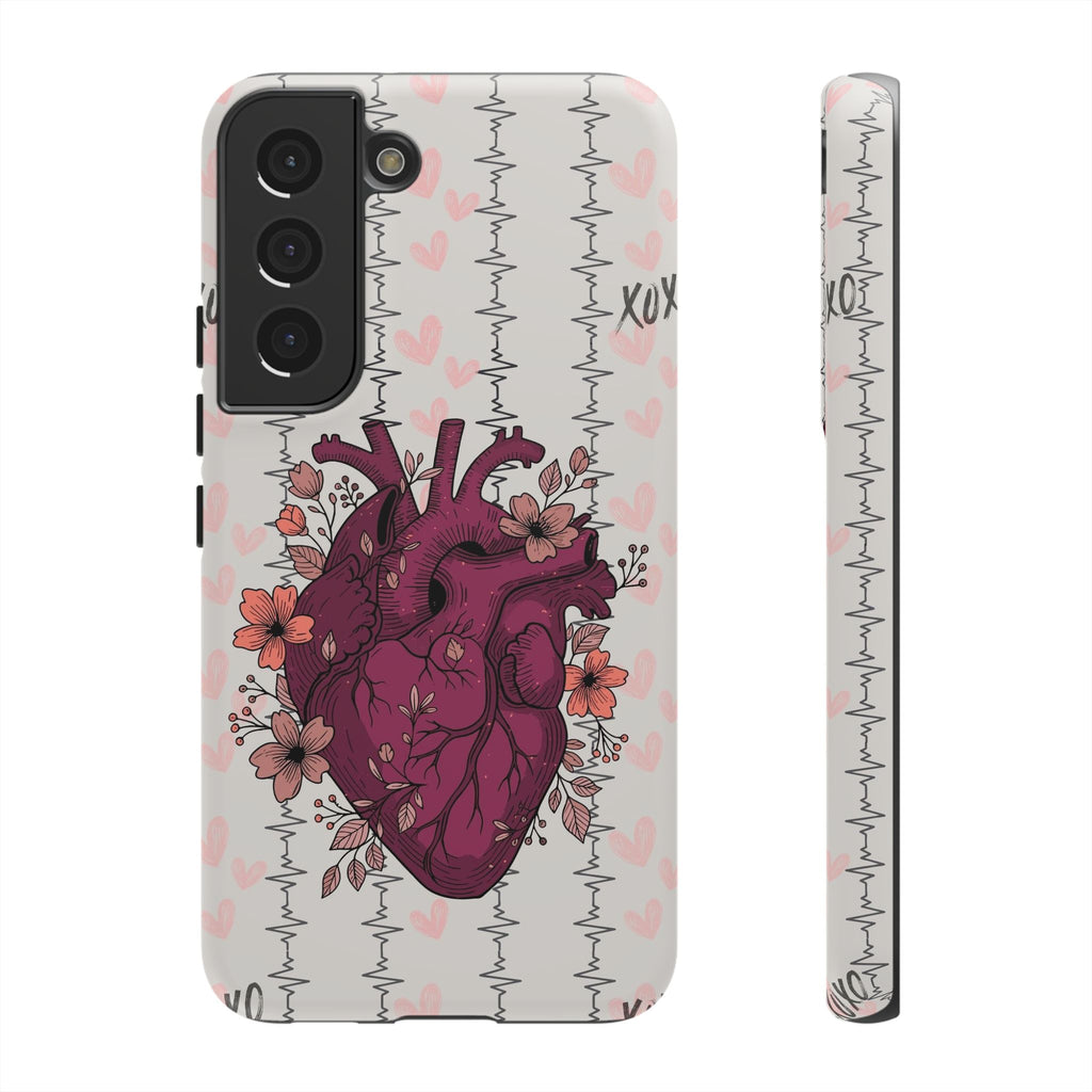 Anatomical Heart Phone Case