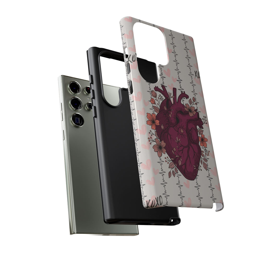 Anatomical Heart Phone Case
