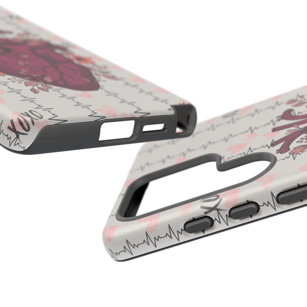 Anatomical Heart Phone Case