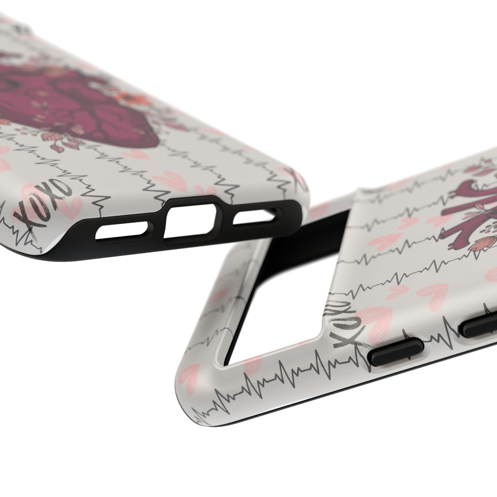 Anatomical Heart Phone Case