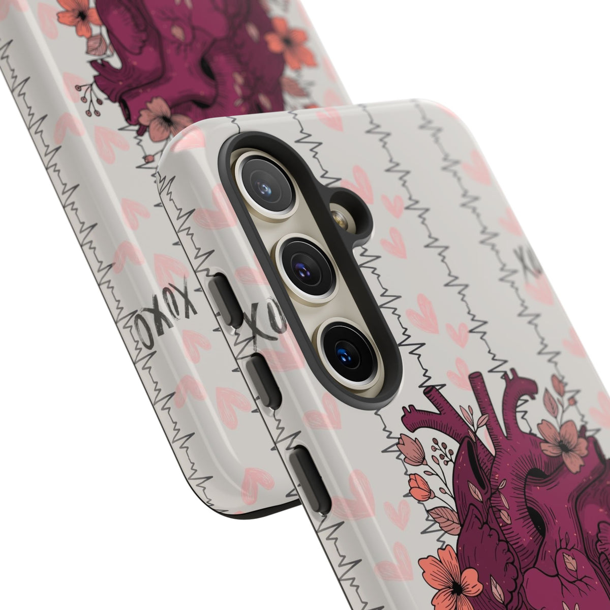 Anatomical Heart Phone Case
