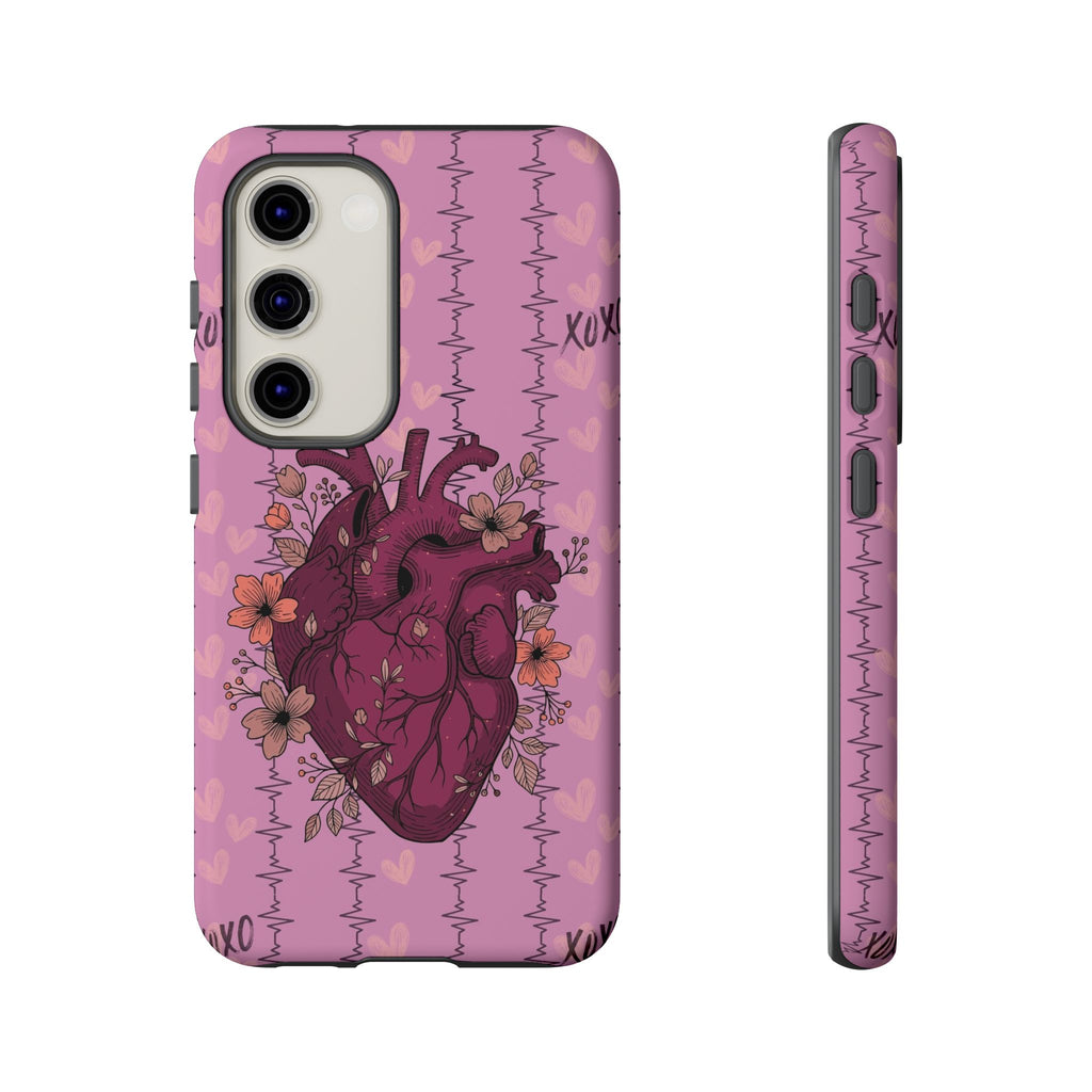 Pink Anatomical Heart Phone Case