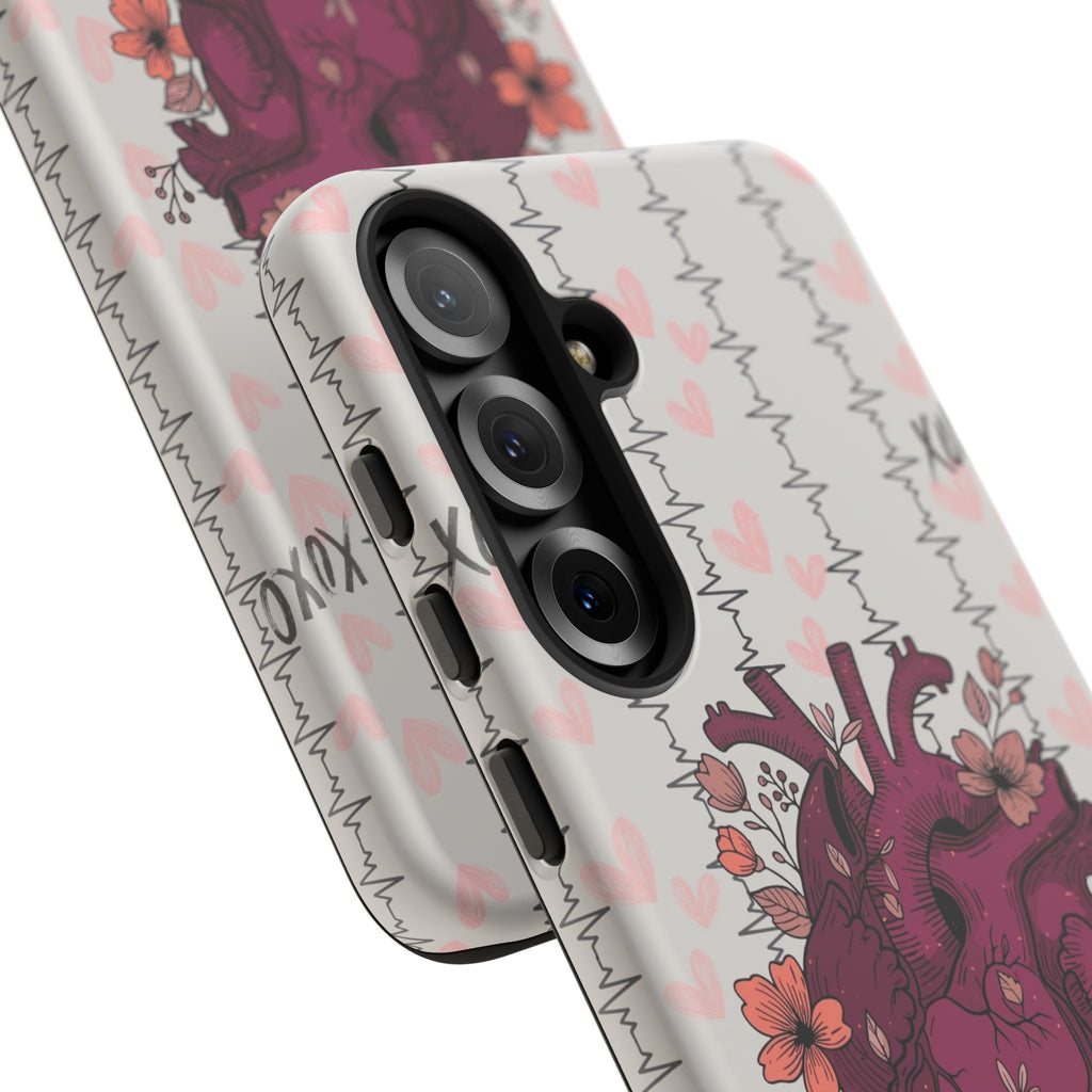 Anatomical Heart Phone Case