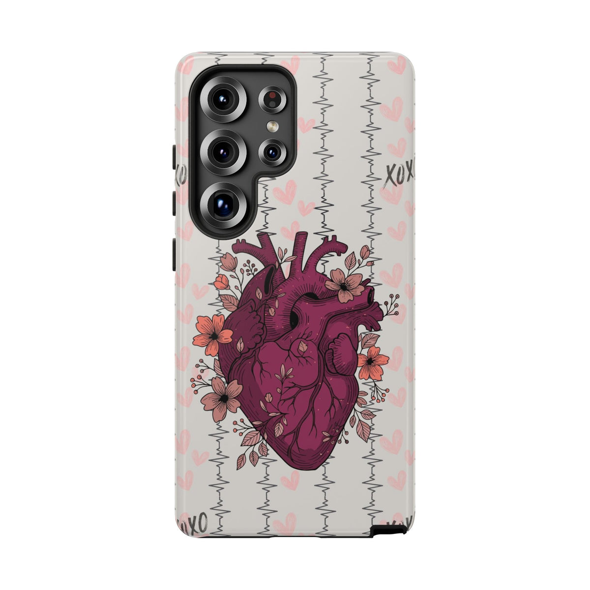 Anatomical Heart Phone Case