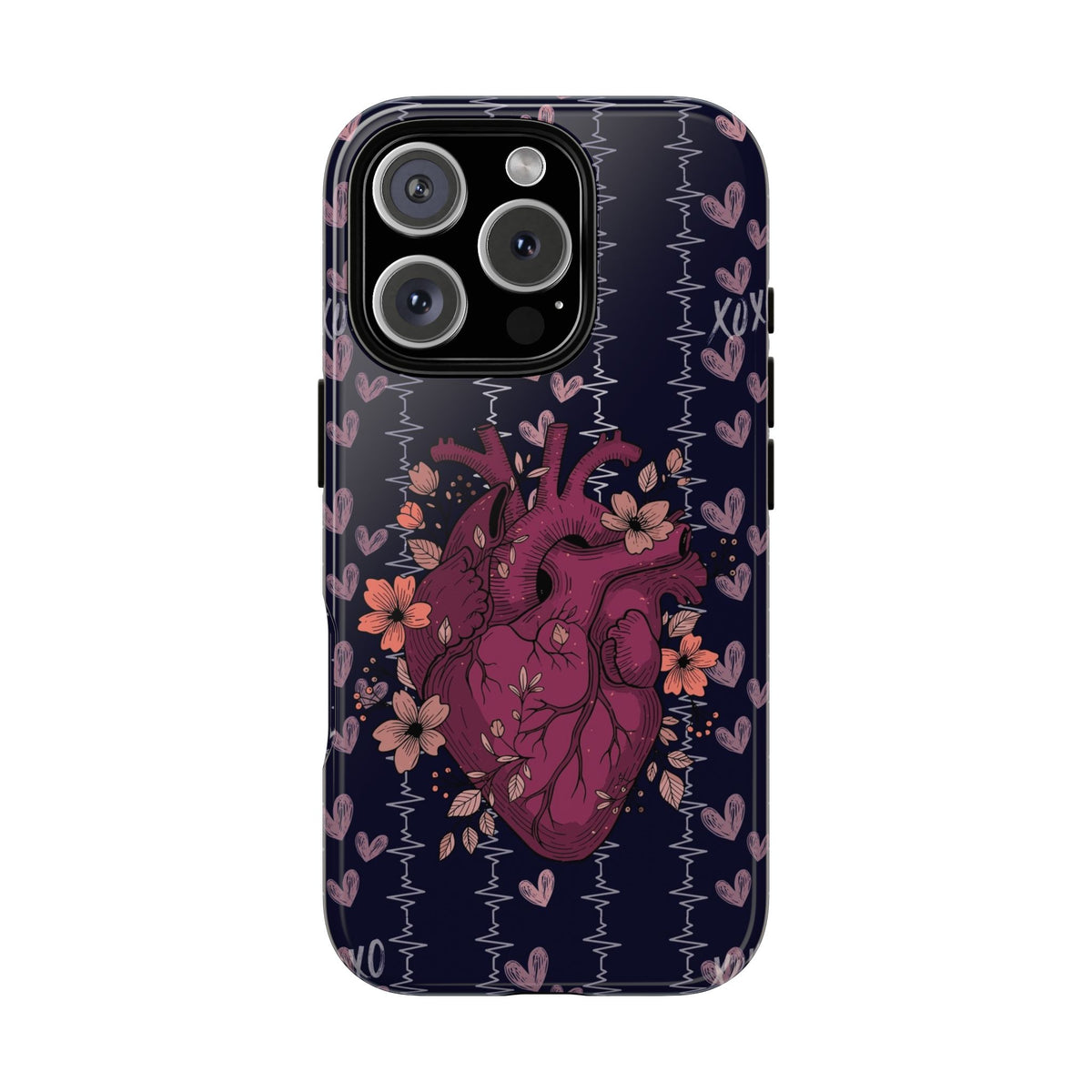 Dark Anatomical Heart Phone Case