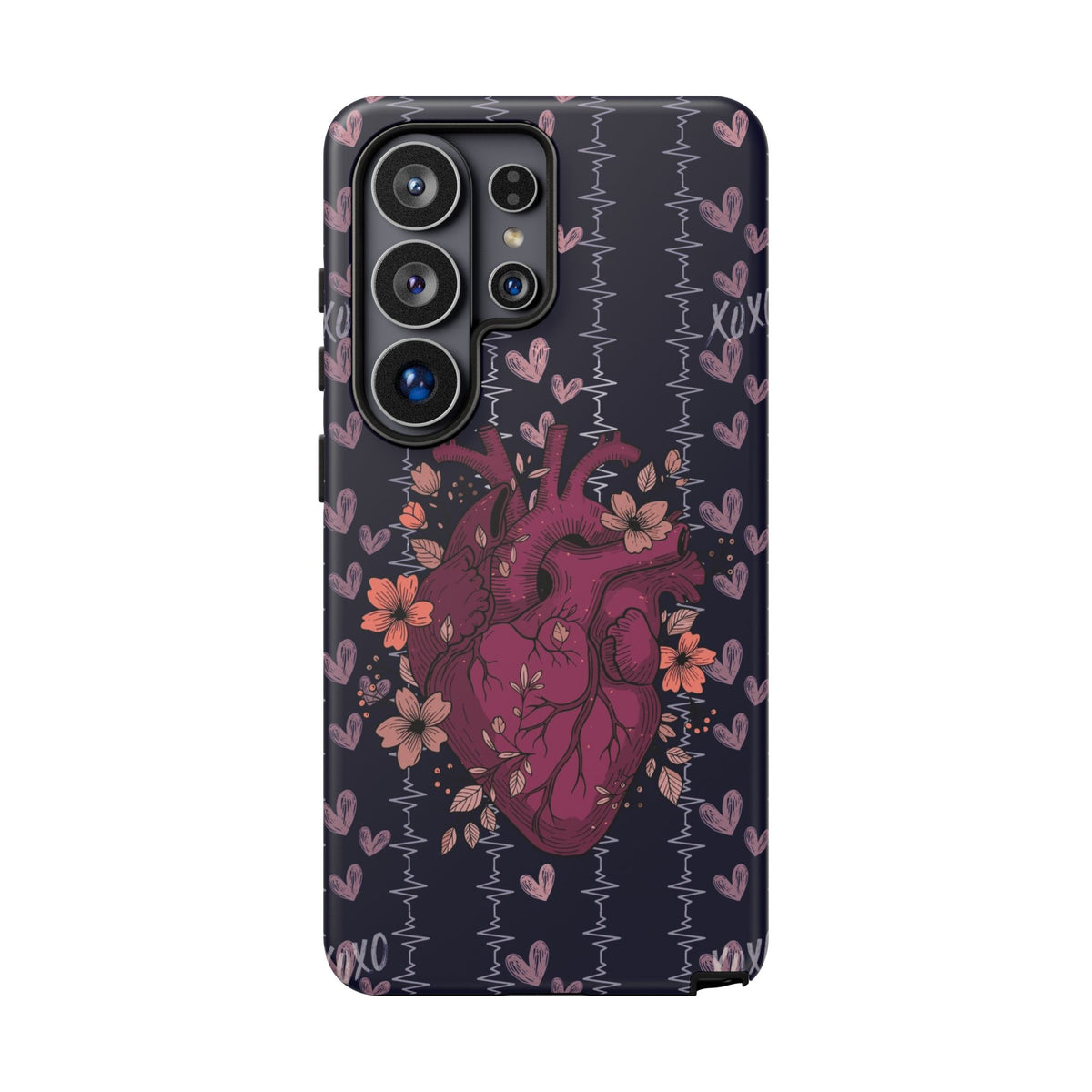 Dark Anatomical Heart Phone Case