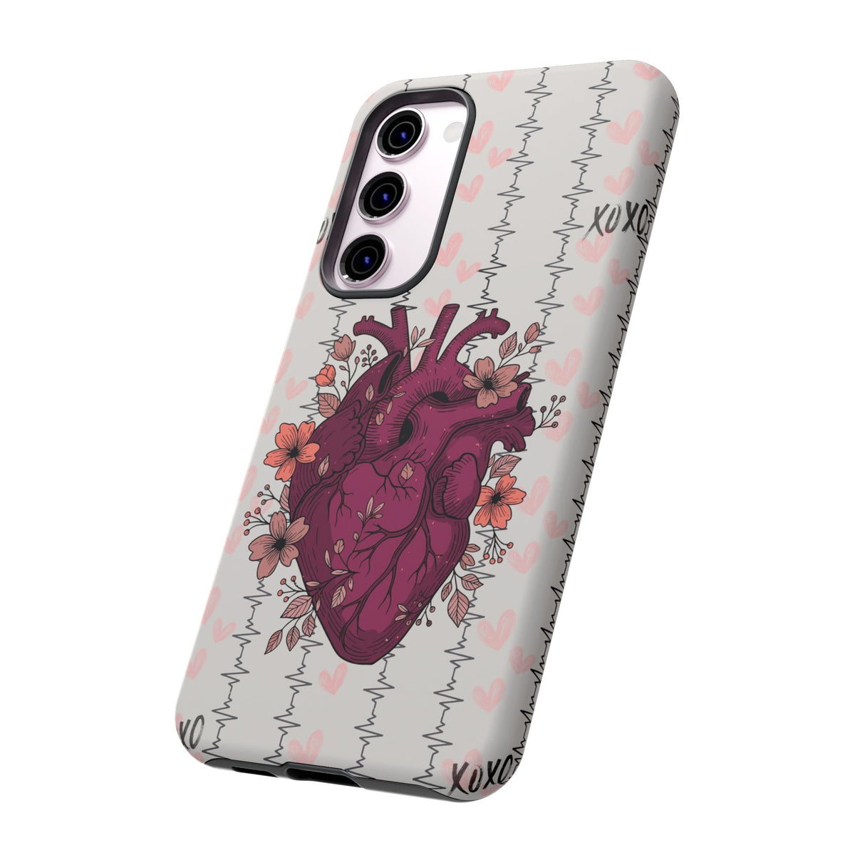 Anatomical Heart Phone Case