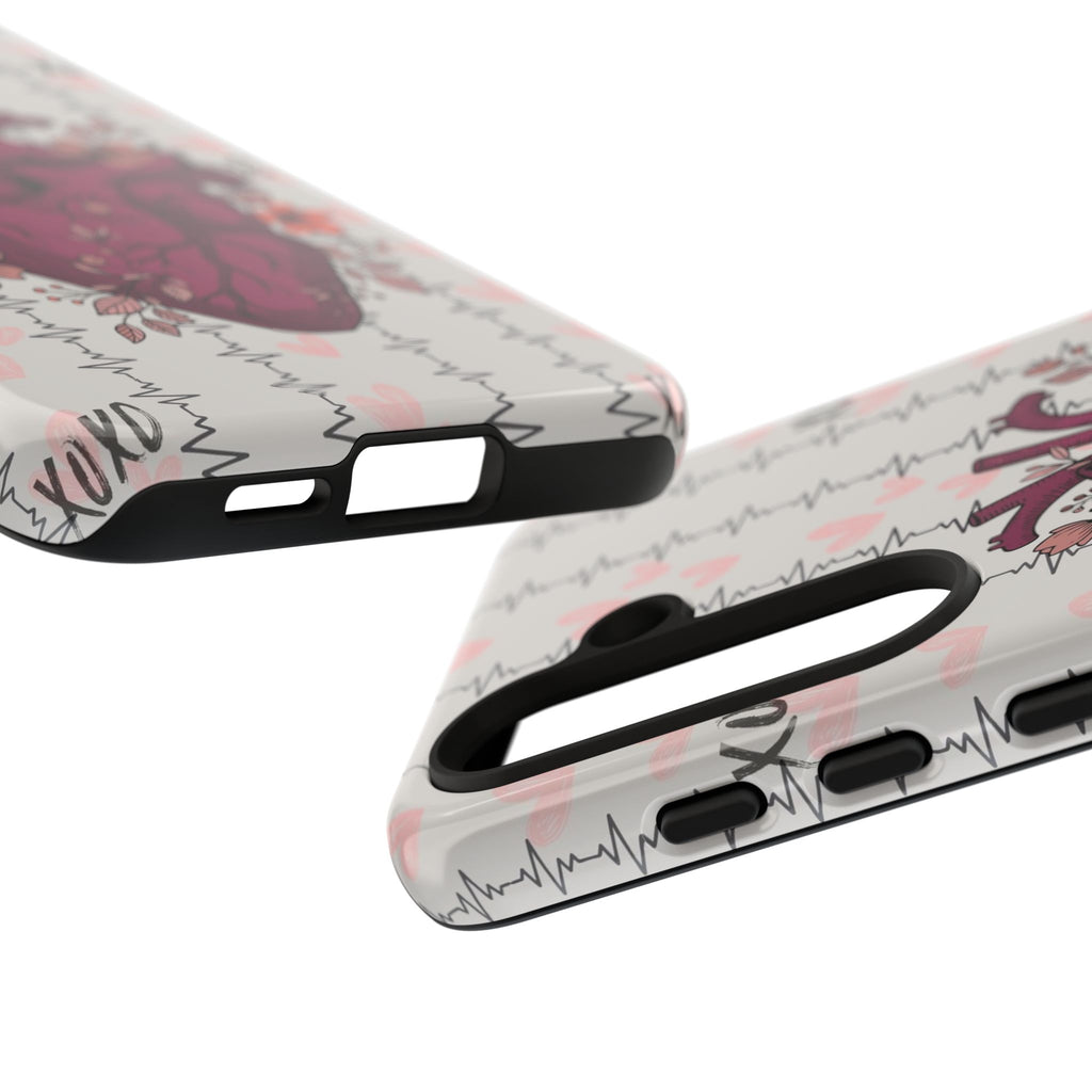 Anatomical Heart Phone Case