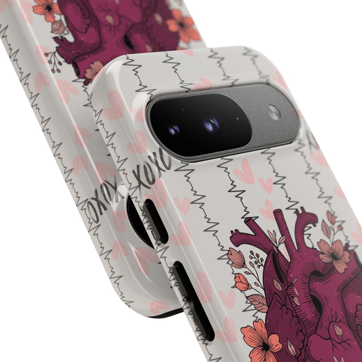 Anatomical Heart Phone Case