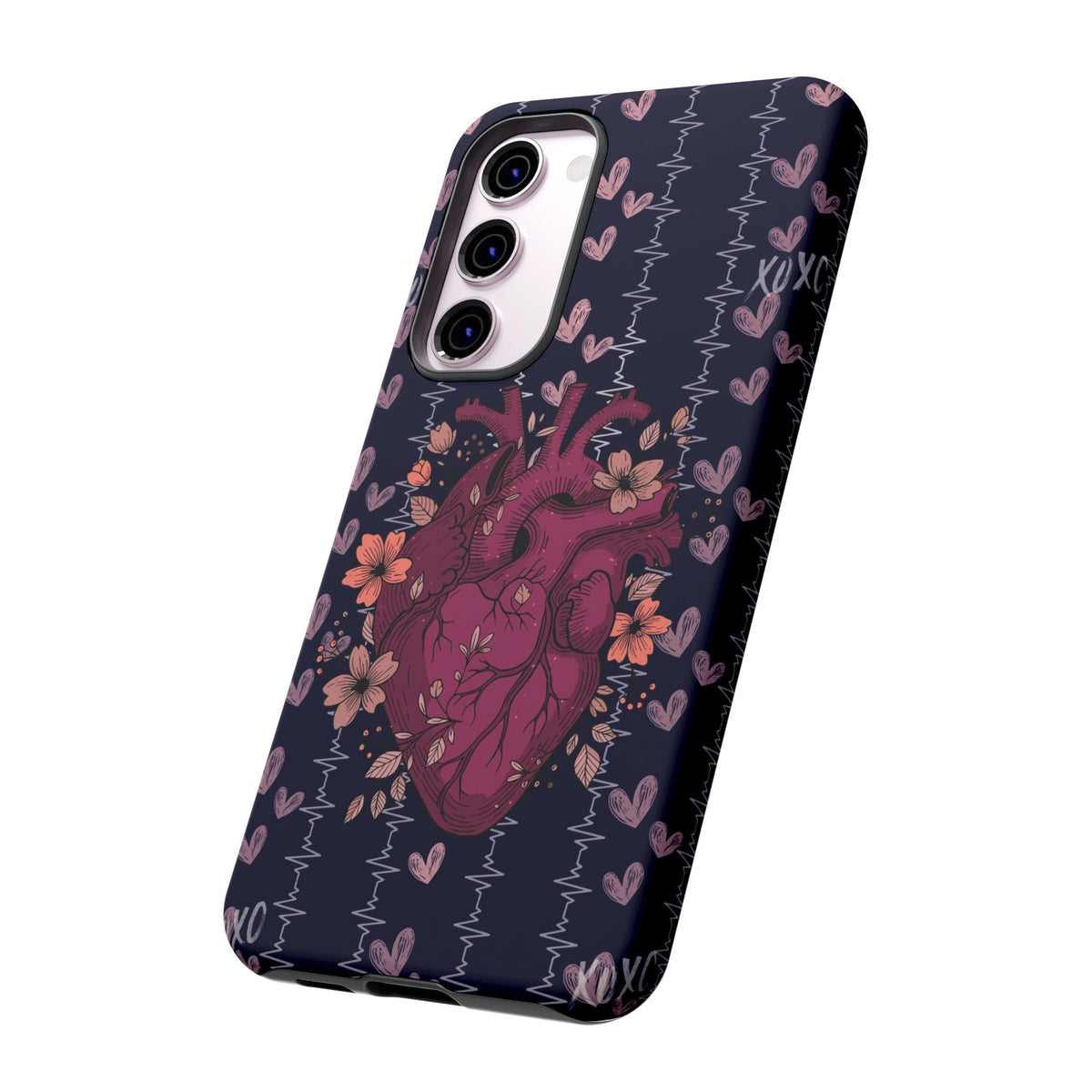 Dark Anatomical Heart Phone Case