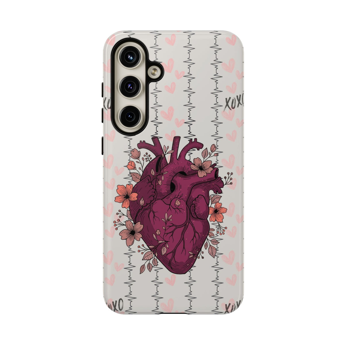 Anatomical Heart Phone Case