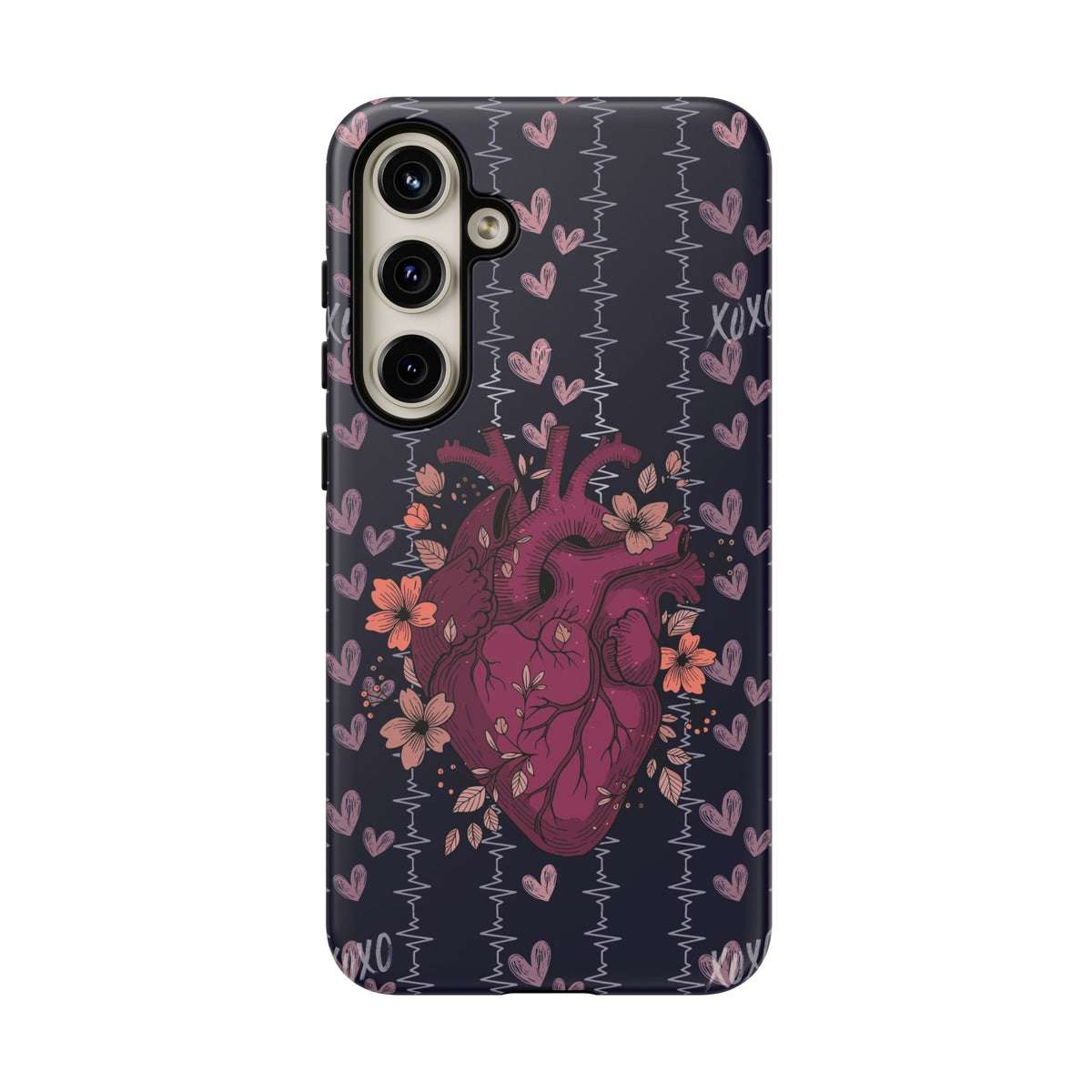Dark Anatomical Heart Phone Case