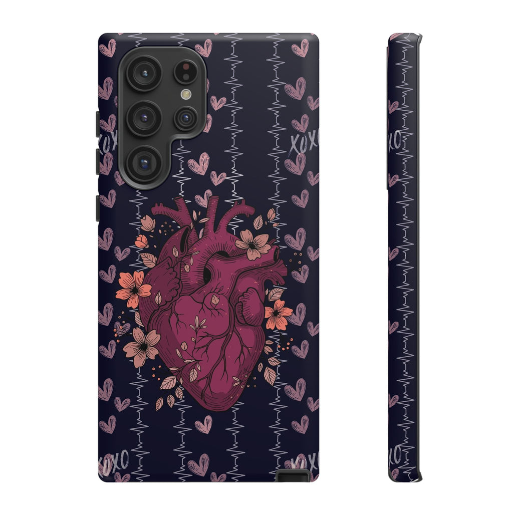 Dark Anatomical Heart Phone Case
