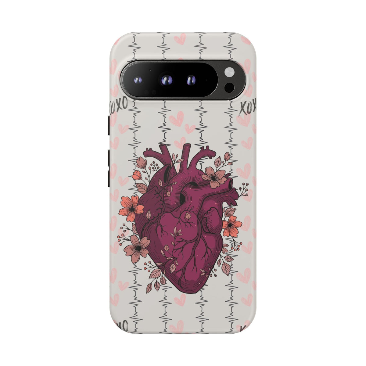 Anatomical Heart Phone Case