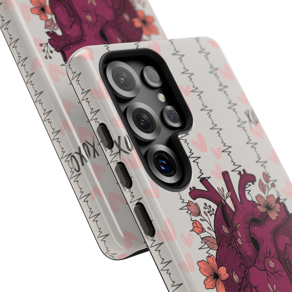 Anatomical Heart Phone Case