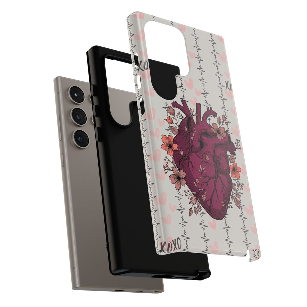 Anatomical Heart Phone Case