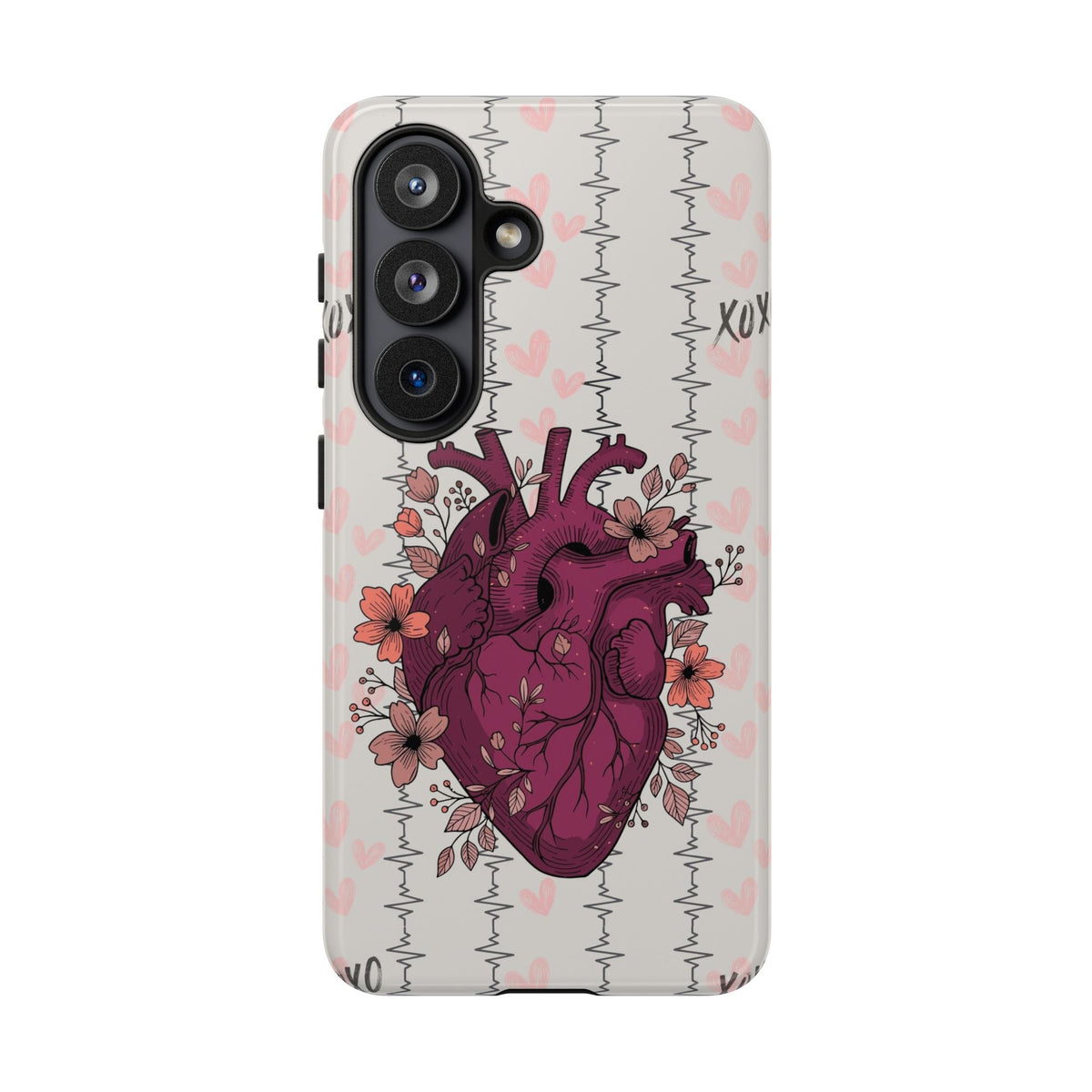 Anatomical Heart Phone Case