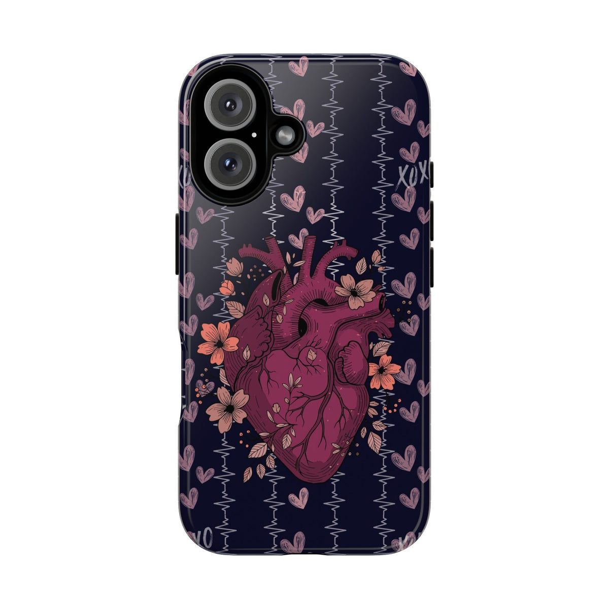 Dark Anatomical Heart Phone Case