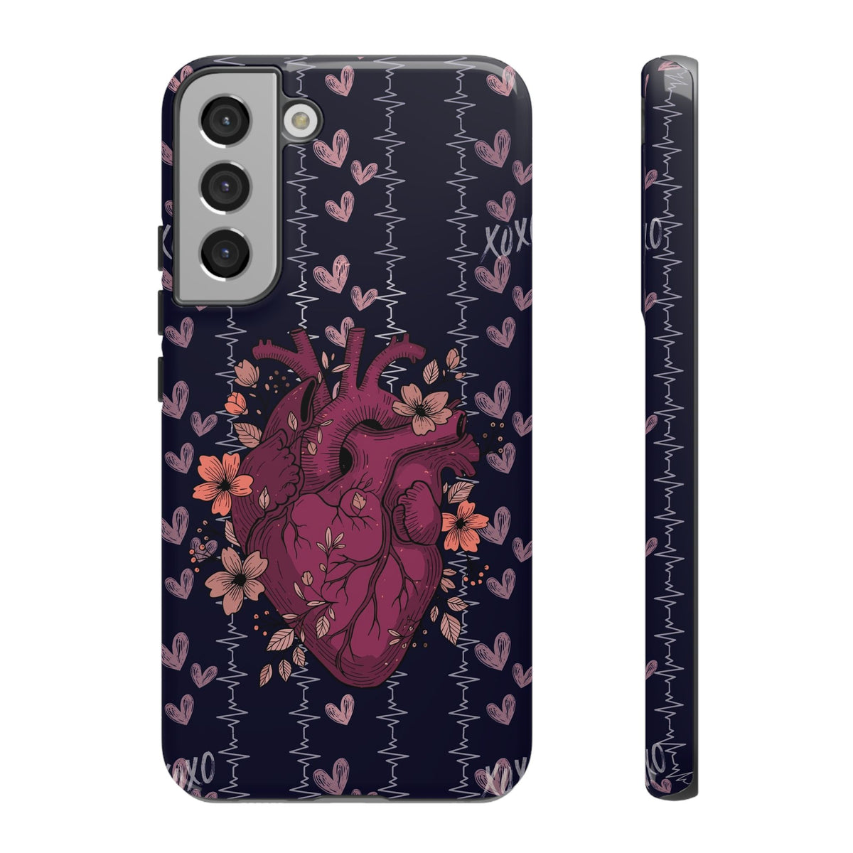 Dark Anatomical Heart Phone Case
