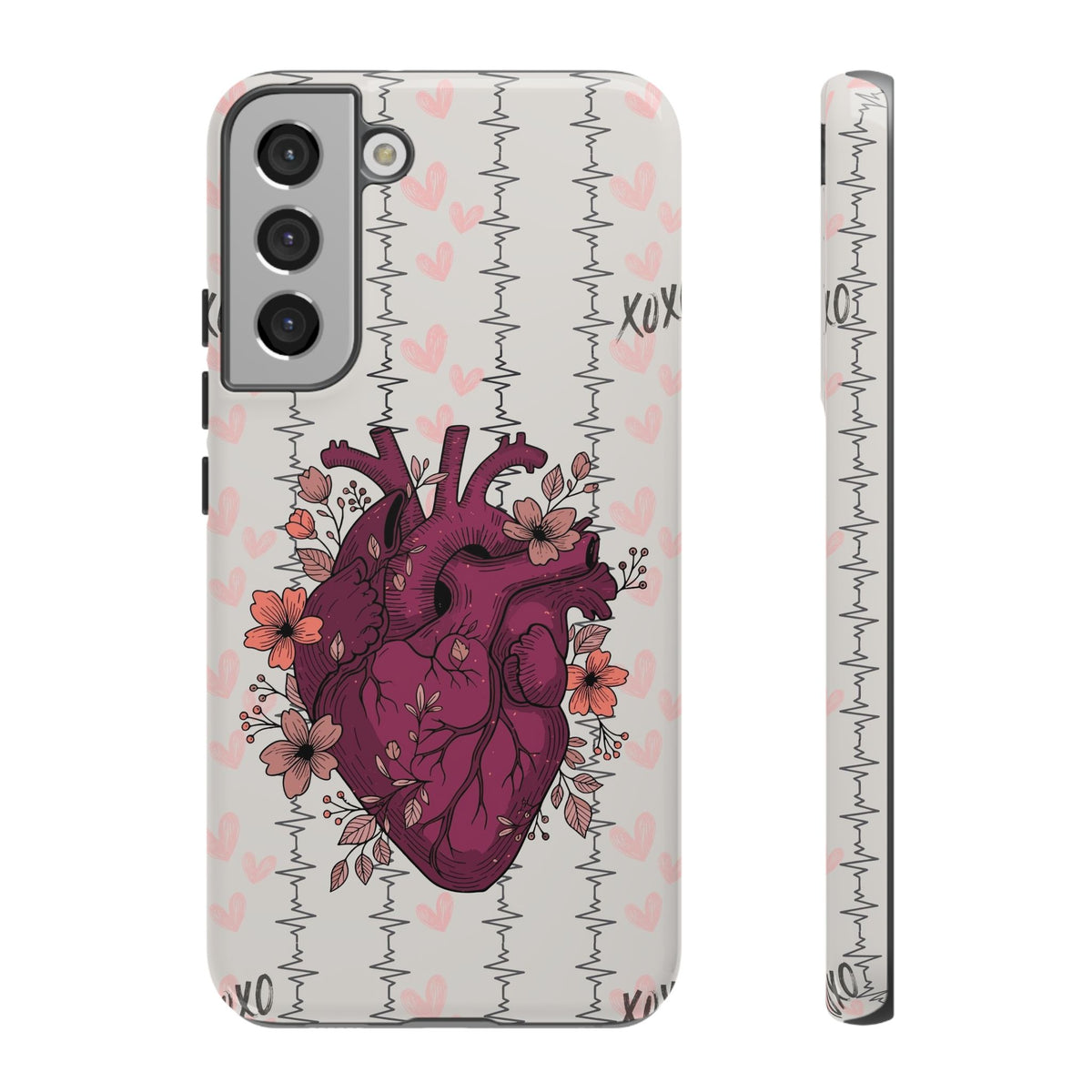 Anatomical Heart Phone Case