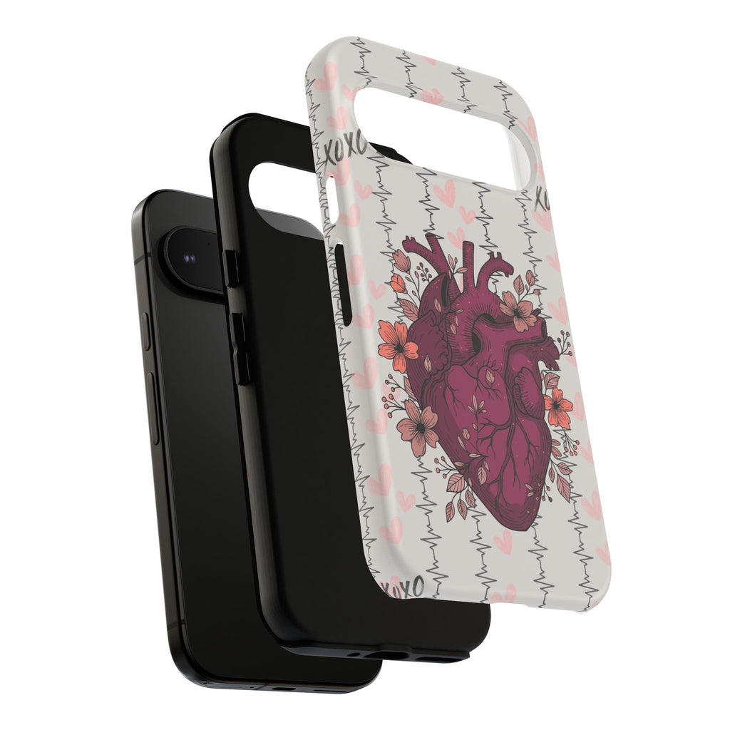 Anatomical Heart Phone Case