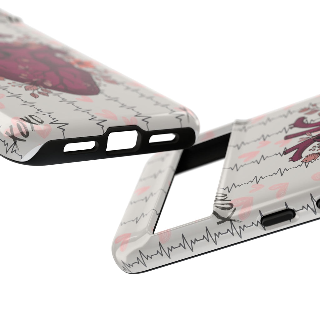 Anatomical Heart Phone Case